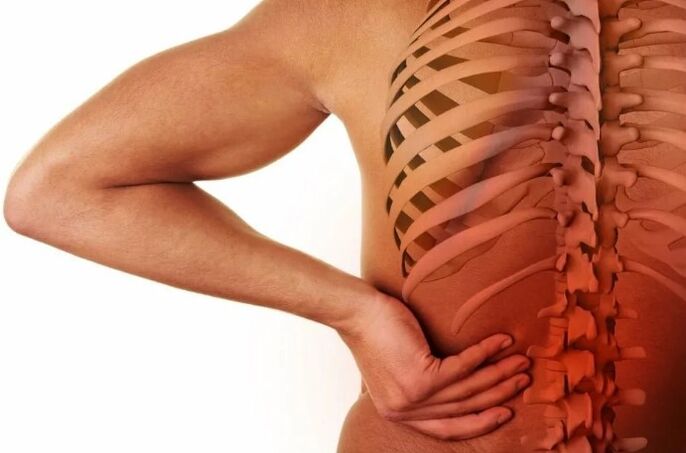 Osteochondrosis lumbar
