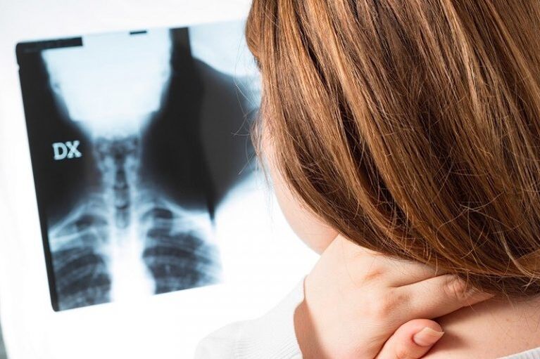 X -ray den réigiún ceirbheacs