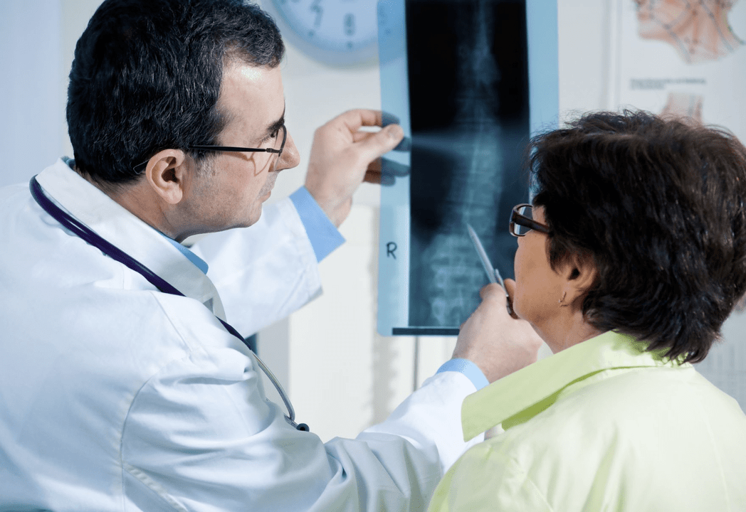 Déanann néareolaí osteochondrosis a dhiagnóisiú ag baint úsáide as radagrafaíocht an spine