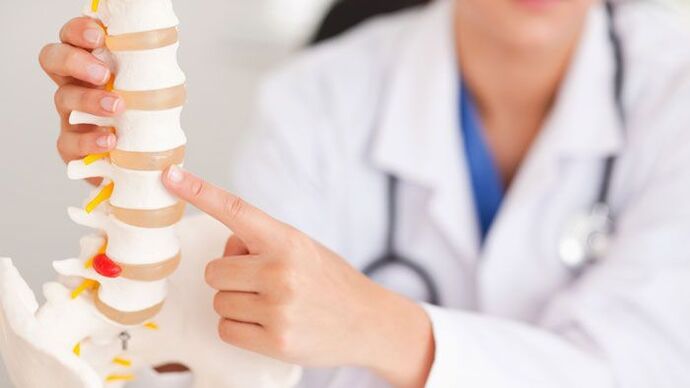 míniú ar osteochondrosis lumbar ar mhúnla den spine